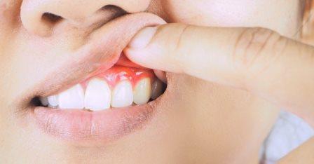 Лечение воспалений зубов – стоматология 21 Век, Краснодар 